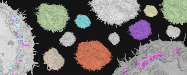 Correlative Light & Electron Microscopy (CLEM)