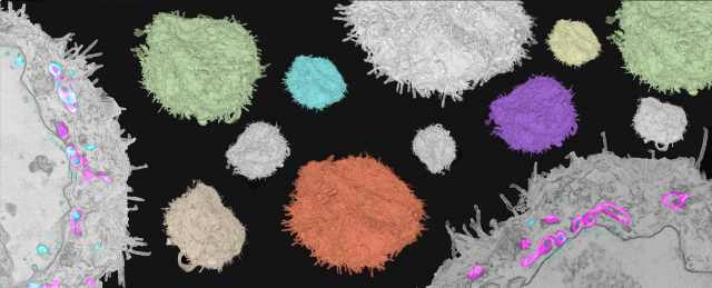 Correlative Light & Electron Microscopy (CLEM) 