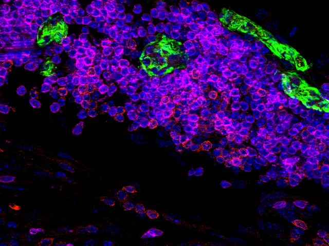 Immune Niches in Cancer & Inflammation - campaign visual