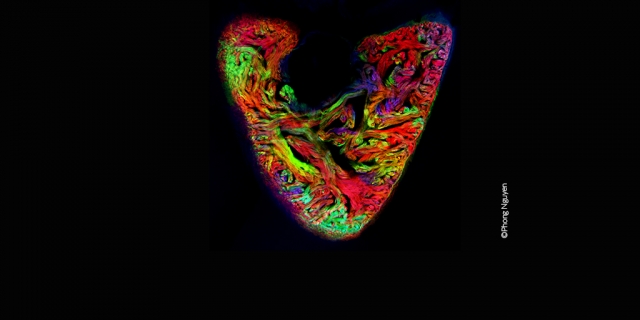 uninjured adult heart