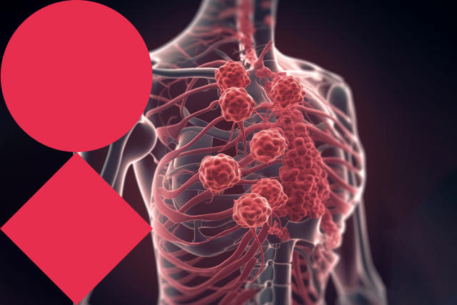 The tumor micro- and macroenvironment