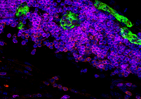 Immune Niches in Cancer & Inflammation - campaign visual