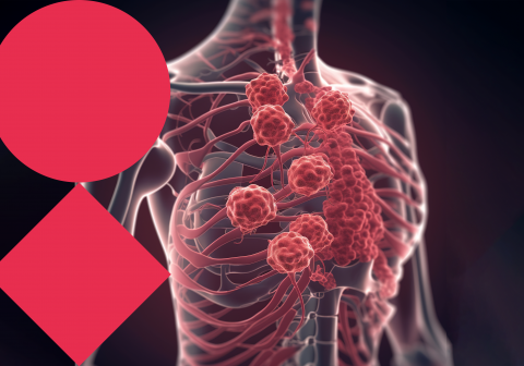 The tumor micro- and macroenvironment